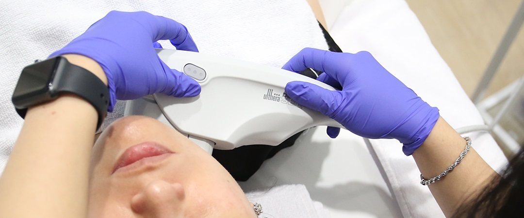 Ultherapy vs HIFU untuk Melasma: Apakah Efektif?
