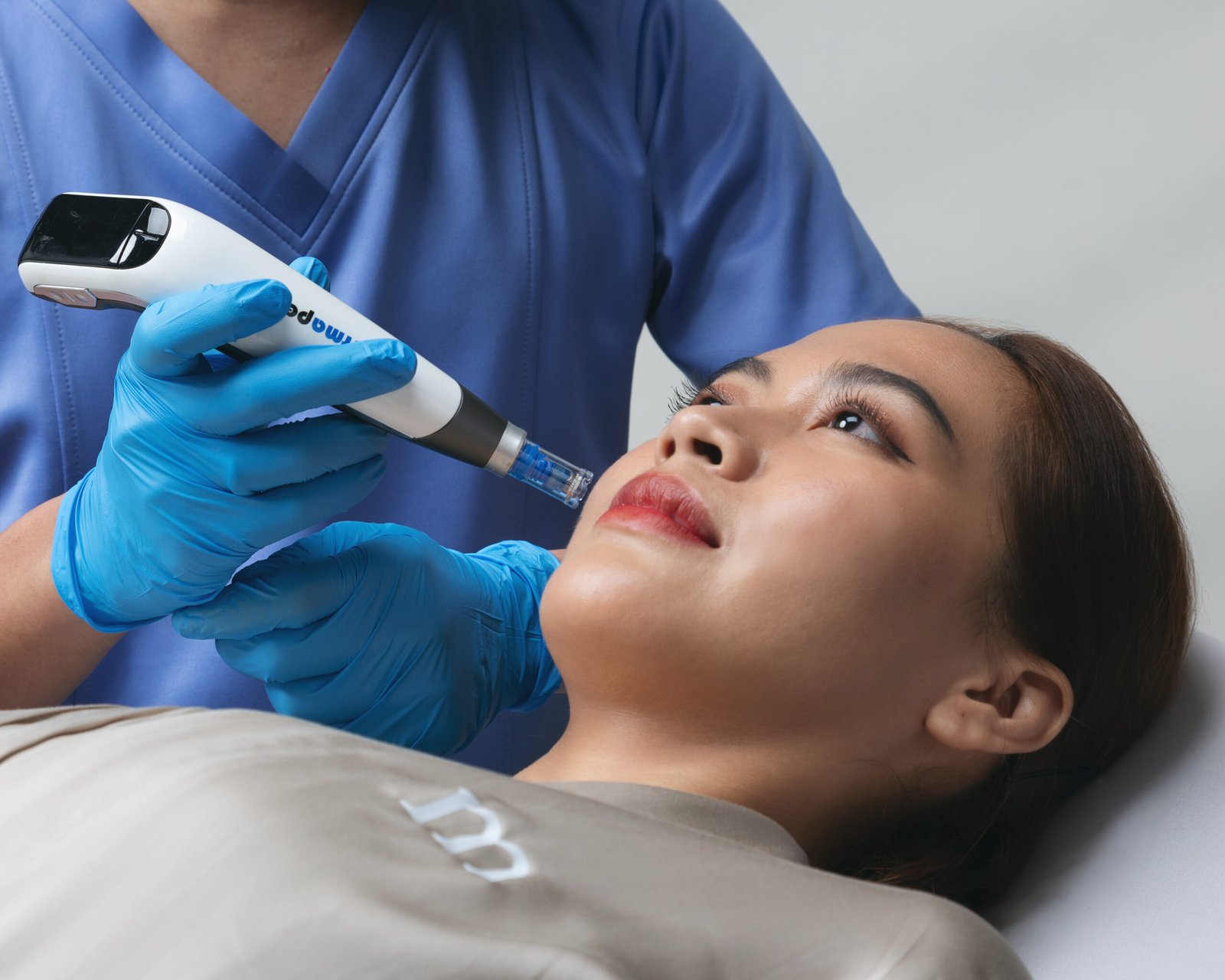 Bukan Sekadar Laser: Inilah Cara Baru Mengatasi Melasma dengan 4 Steps Laser, Salmon DNA, Skin Booster dan Exosome