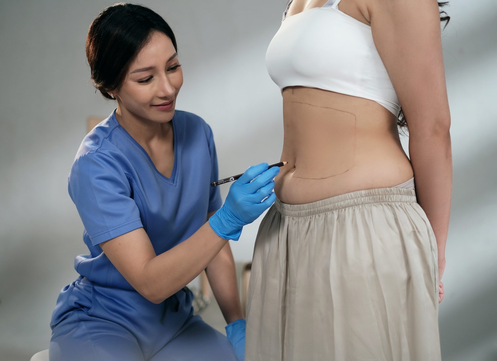 Fat Graft : Prosedur Counturing dan Rejuvinasi Wajah dengan memberikan hasil yang Natural