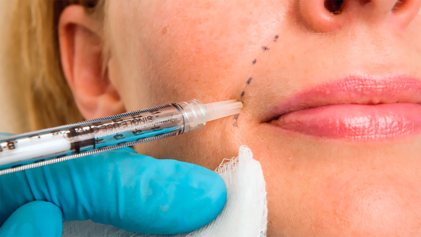 Collagen Stimulator, Solusi Anti-Aging untuk Kulit Lebih Kencang dan Fresh