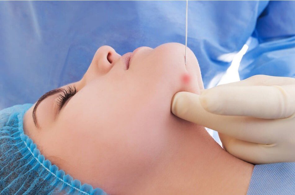 Your Face Deserves the Authentic Endolift Experience
